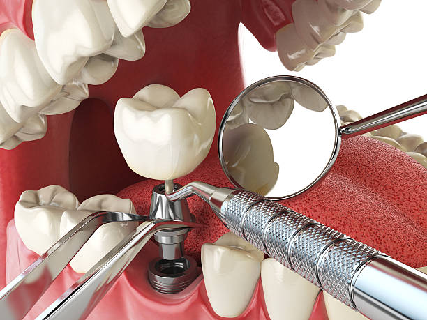 Best Emergency Care for Gum Disease in Welch, WV